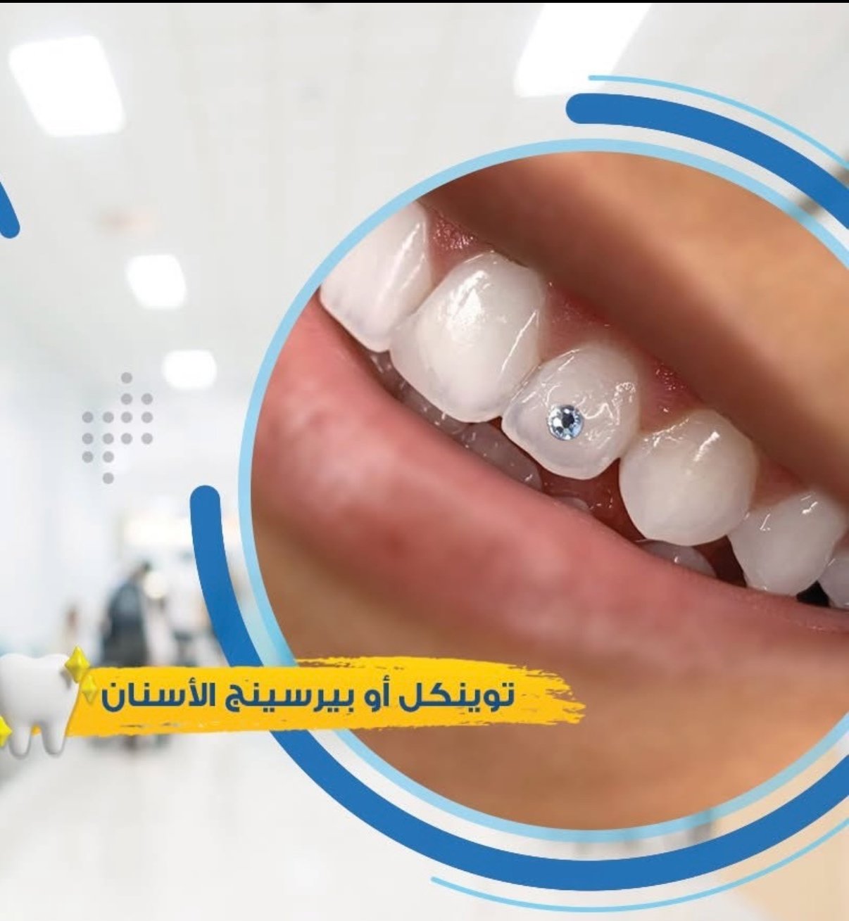 توينكل و كريستالة الاسنان