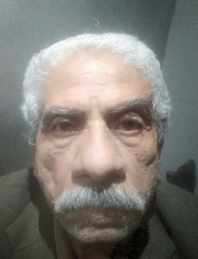 Dr Esmat Eshak OphthalmologyDr Esmat Eshak