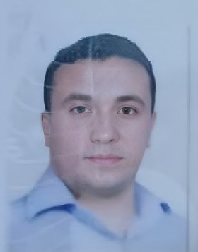 Dr Ahmed Al masry Surgical Oncology and LaparoscopyDr Ahmed Al masry