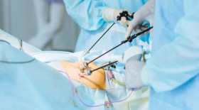 Laparoscopic Cholecystectommy - Islam Zedan's clinic